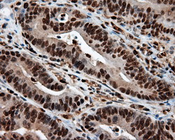 m02399 anti leukotriene a4 hydrolase lta4h mouse monoclonal antibody clone id oti7d11 ihc testing 12