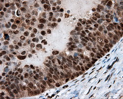 m02399 anti leukotriene a4 hydrolase lta4h mouse monoclonal antibody clone id oti7d11 ihc testing 3
