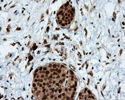 m02399 anti leukotriene a4 hydrolase lta4h mouse monoclonal antibody clone id oti7d11 ihc testing 5