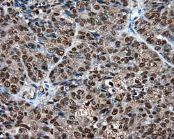 m02399 anti leukotriene a4 hydrolase lta4h mouse monoclonal antibody clone id oti7d11 ihc testing 7