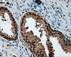 m02399 anti leukotriene a4 hydrolase lta4h mouse monoclonal antibody clone id oti7d11 ihc testing 8