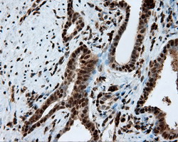 m02399 anti leukotriene a4 hydrolase lta4h mouse monoclonal antibody clone id oti7d11 ihc testing 9