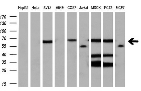 m02399 anti leukotriene a4 hydrolase lta4h mouse monoclonal antibody clone id oti7d11 wb testing 2