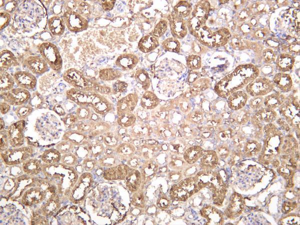 Rat kidney was stained with anti-Ferritin Heavy Chain rabbit antibody