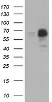 HEK293T cells were transfected with the pCMV6-ENTRY control (Left lane) or pCMV6-ENTRY PEX5 (Right lane) cDNA for 48 hrs and lysed