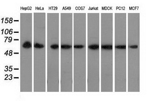 Western blot analysis of extracts (35ug) from 9 different cell lines by using anti-PEX5 monoclonal antibody