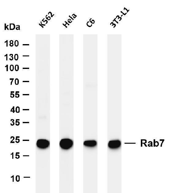 Various whole cell lysates were separated by 4-20% SDS-PAGE, and the membrane was blotted with anti-Rab7 antibody