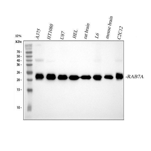 m02409 rab7 primary antibodies wb testing 1