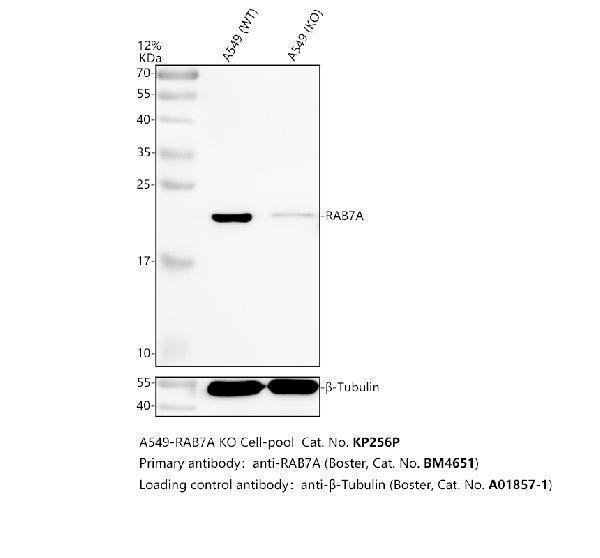 Western blot analysis of RAB7A using anti-RAB7A antibody (M02409)