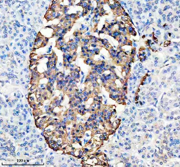 IHC analysis of IGFBP7 using anti-IGFBP7 antibody (M02410)