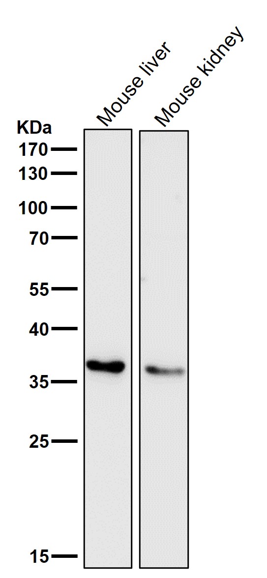 All lanes use the Antibody at 1:5k dilution for 1 hour at room temperature.