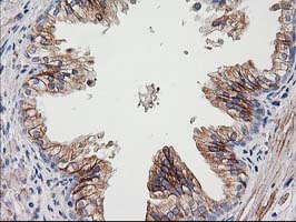 Immunohistochemical staining of paraffin-embedded Human prostate tissue within the normal limits using anti-CDCP1 mouse monoclonal antibody