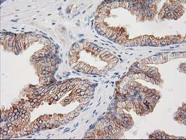 m02411 anti cdcp1 mouse monoclonal antibody clone id oti2c1 ihc testing 4