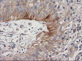 m02411 anti cdcp1 mouse monoclonal antibody clone id oti2c1 ihc testing 5