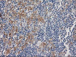 m02411 anti cdcp1 mouse monoclonal antibody clone id oti2c1 ihc testing 6
