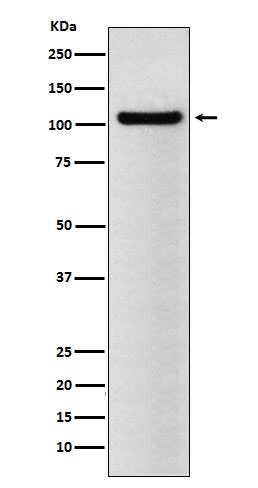 Western blot analysis of BRD2 expression in NCCIT cell lysate