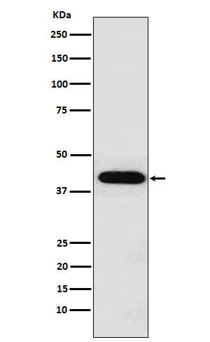 Western blot analysis of Inhibin alpha expression in HeLa cell lysate