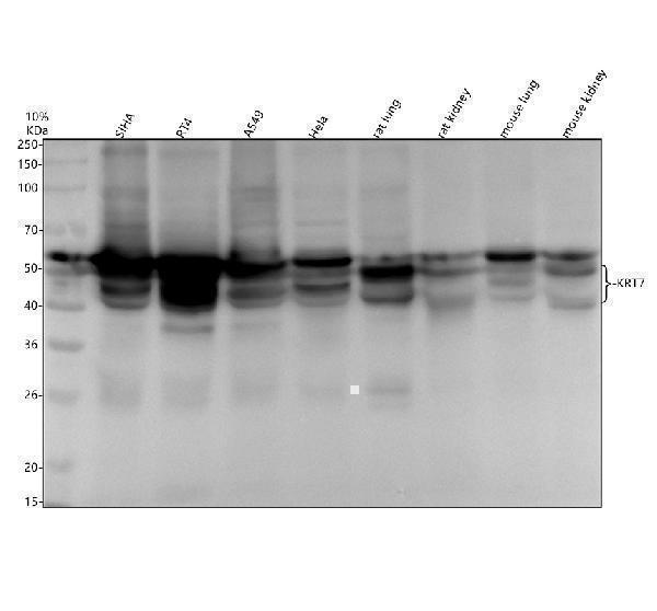 m02416 2 krt7 primary antibodies wb testing 1