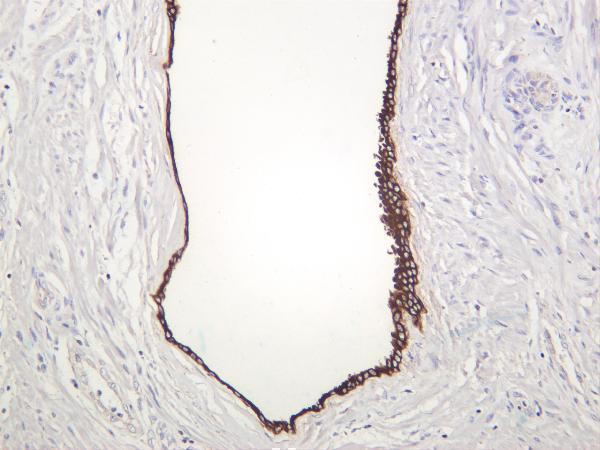 Human prostate was stained with anti-Cytokeratin 7 rabbit antibody