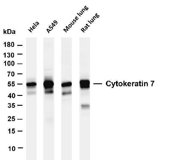 m02416 4 krt7 primary antibodies wb testing 1