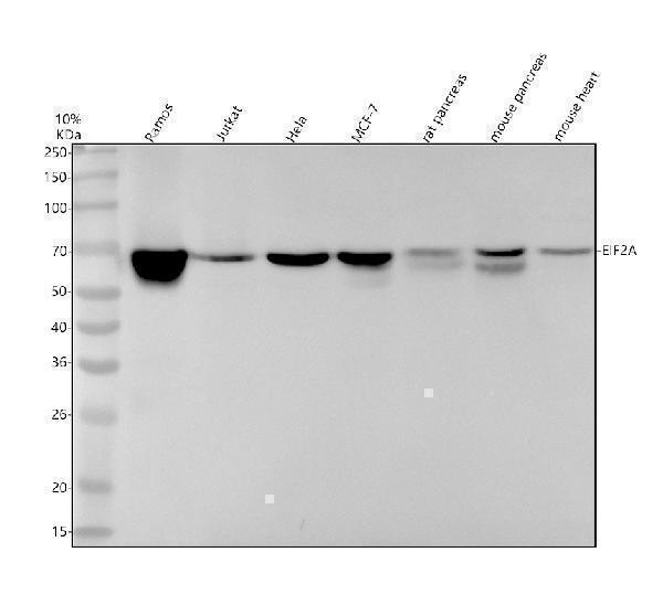 Western blot analysis of EIF2A using anti-EIF2A antibody (M02418)