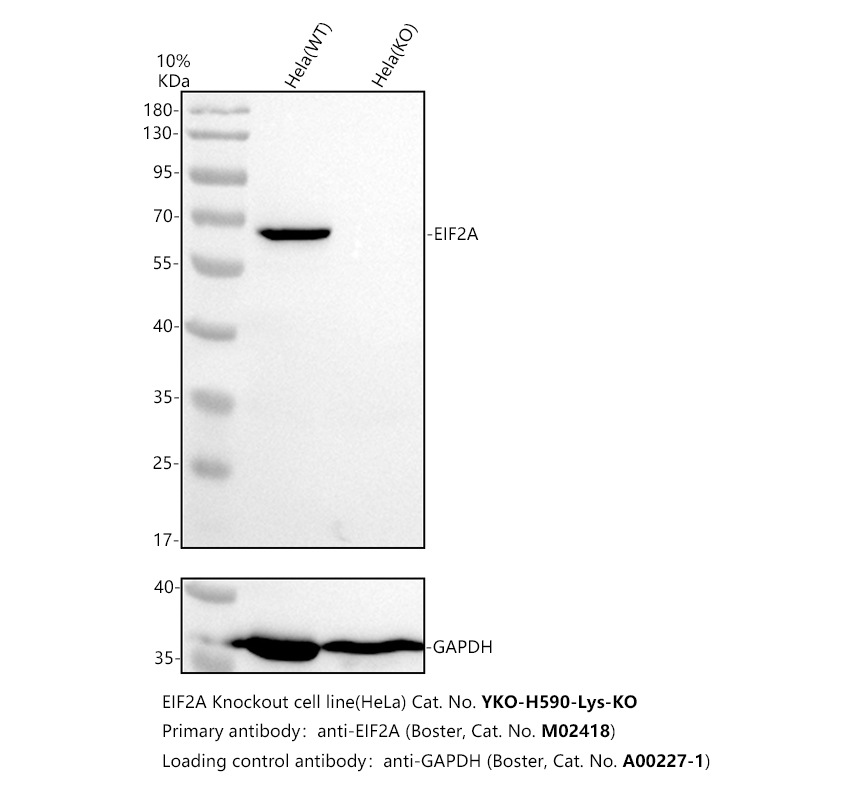 Western blot analysis of EIF2A using anti-EIF2A antibody (M02418)
