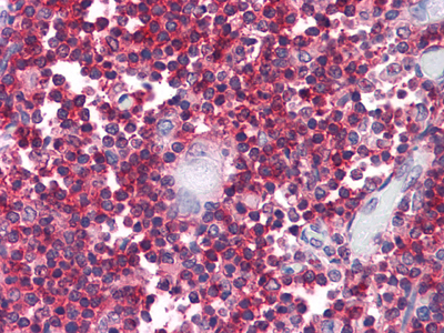 Immunohistochemistry analysis of paraffin-embedded human Thymus tissues with AEC staining using CD247 Monoclonal Antibody