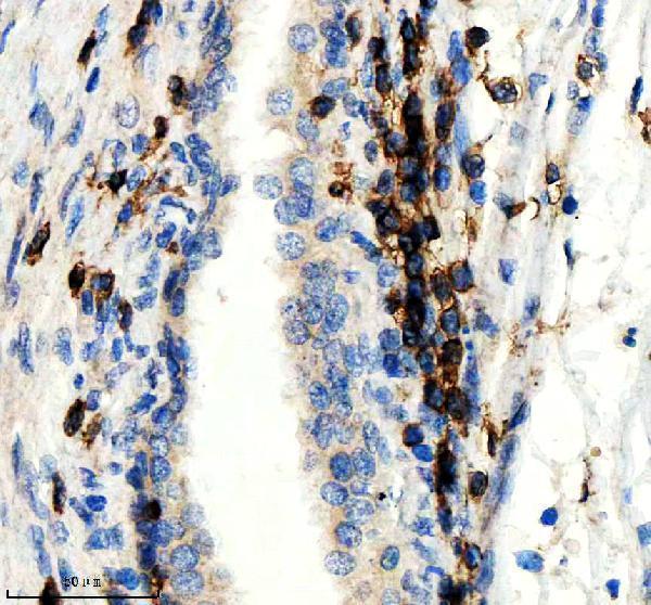 IHC analysis of CD3Z using anti-CD3Z antibody (M02421)