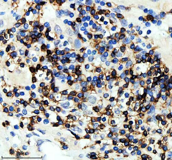 IHC analysis of CD3Z using anti-CD3Z antibody (M02421)