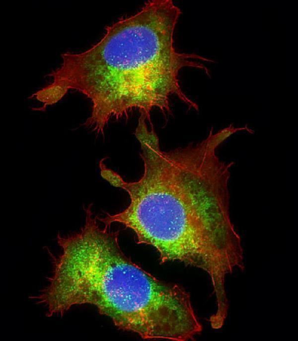 m02424 1 anti cyclophilin d antibody if testing 1