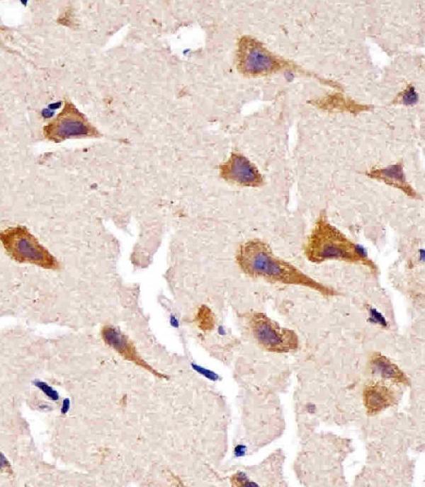 m02424 1 anti cyclophilin d antibody ihc p testing 3