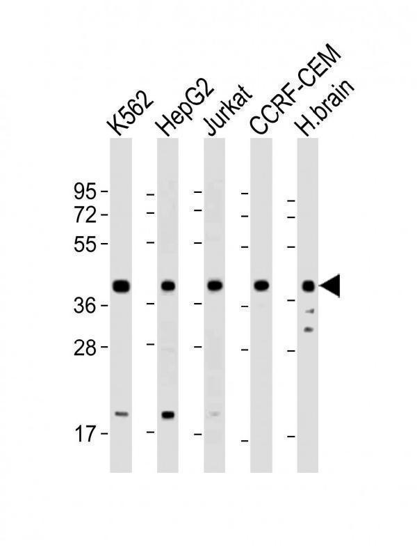m02424 1 anti cyclophilin d antibody wb testing 2