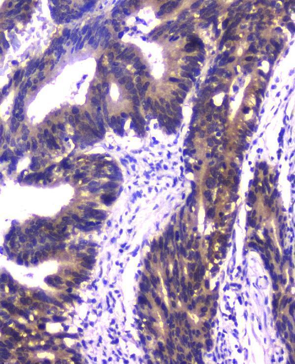  IHC analysis of PPID using anti-PPID antibody (M02424)
