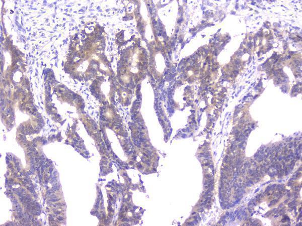 m02424 ppid primary antibodies ihc testing 4