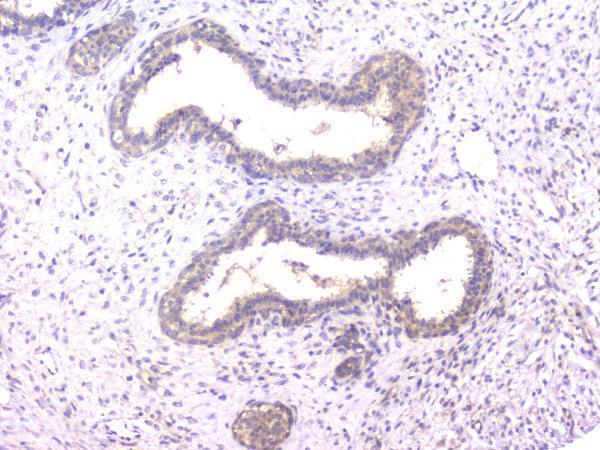 m02424 ppid primary antibodies ihc testing 5