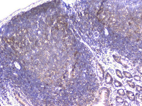 m02424 ppid primary antibodies ihc testing 6