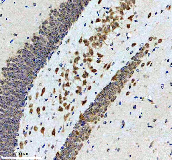 IHC analysis of PCBP2 using anti-PCBP2 antibody (M02425-1)