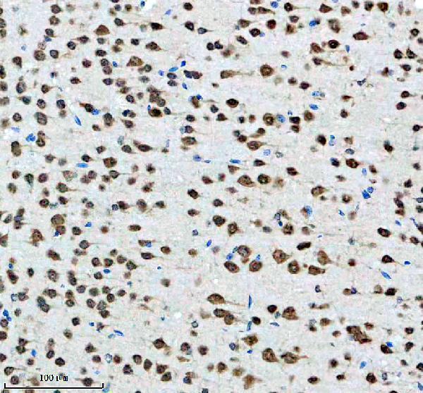 IHC analysis of PCBP2 using anti-PCBP2 antibody (M02425-1)