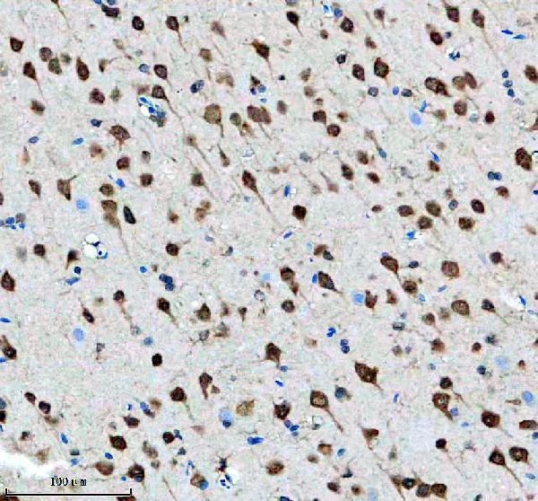 m02425 1 pcbp2 primary antibodies ihc testing 3
