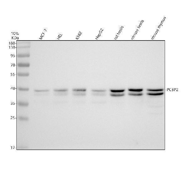 Western blot analysis of PCBP2 using anti-PCBP2 antibody (M02425-1)