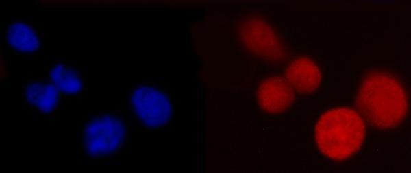  IF analysis of PCBP2/hnRNP E2 using anti-PCBP2/hnRNP E2 antibody (M02425)