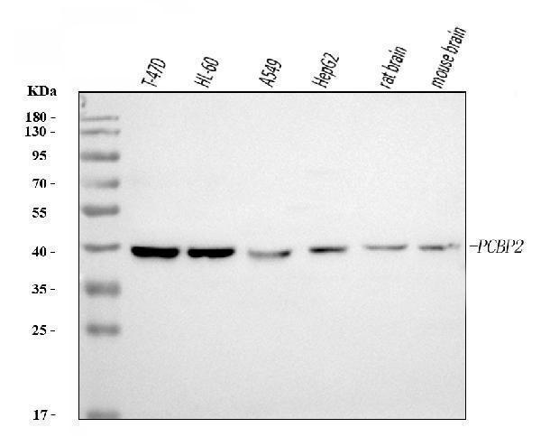  Western blot analysis of PCBP2/hnRNP E2 using anti-PCBP2/hnRNP E2 antibody (M02425)