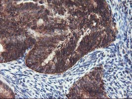 m02426 2 anti hsp75 trap1 mouse monoclonal antibody clone id oti1a1 ihc testing 6