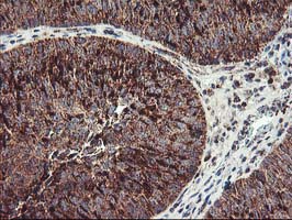 m02426 2 anti hsp75 trap1 mouse monoclonal antibody clone id oti1a1 ihc testing 7