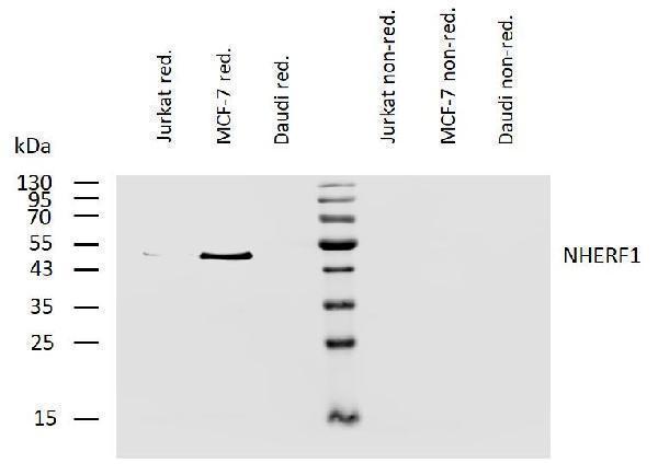Western blotting analysis of human NHERF1 using mouse monoclonal antibody EBP-10 on lysates of Jurkat, MCF-7, and Daudi cells under reducing and non-reducing conditions