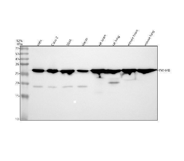  Western blot analysis of YWHAB using anti-YWHAB antibody (M02431-3)