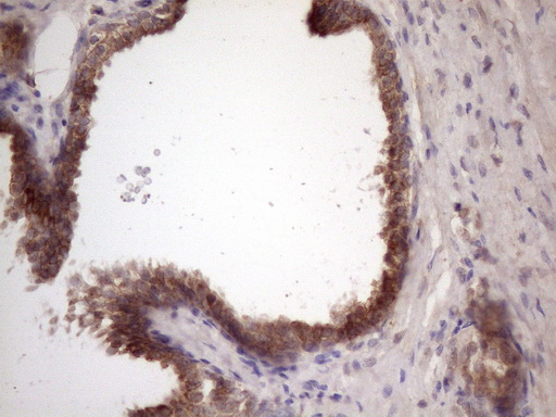 Immunohistochemical staining of paraffin-embedded Human prostate tissue within the normal limits using anti-BMF mouse monoclonal antibody