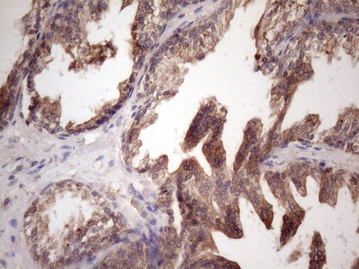 m02432 anti bmf mouse monoclonal antibody clone id oti6f3 ihc testing 4