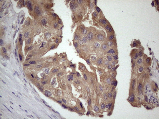m02432 anti bmf mouse monoclonal antibody clone id oti6f3 ihc testing 5