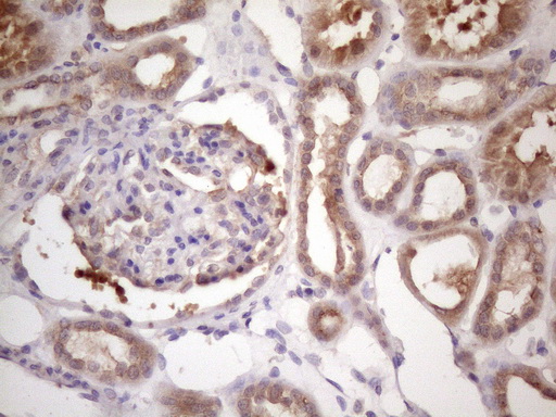 m02432 anti bmf mouse monoclonal antibody clone id oti6f3 ihc testing 6